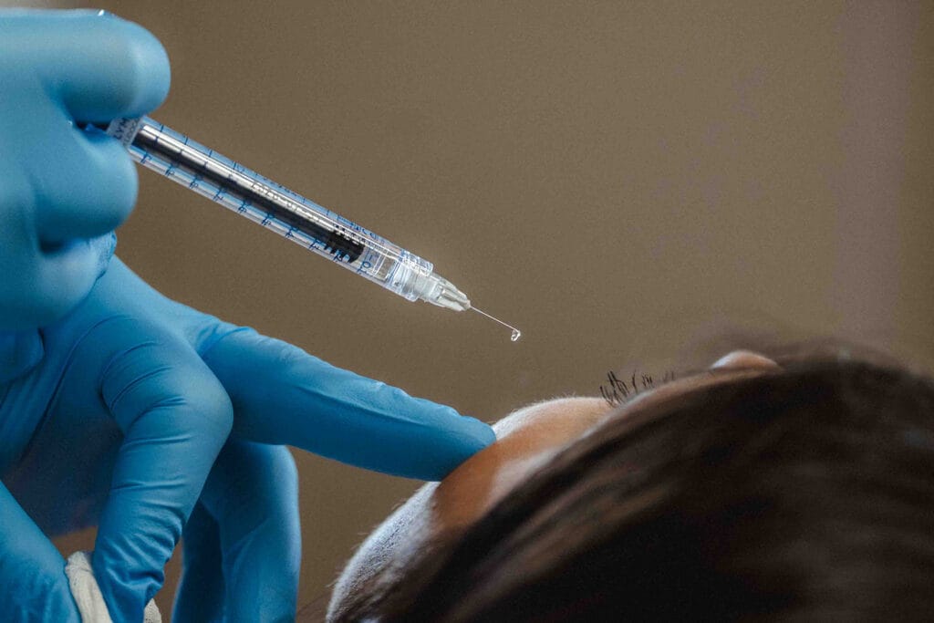 Macro photographie d'une injection de précision à l'acide hyaluronique réalisée par un chirurgien esthétique ganté à Metz.